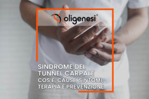 Scopri di più sull'articolo Sindrome del Tunnel Carpale: cos’è, cause, sintomi, terapia e prevenzione
